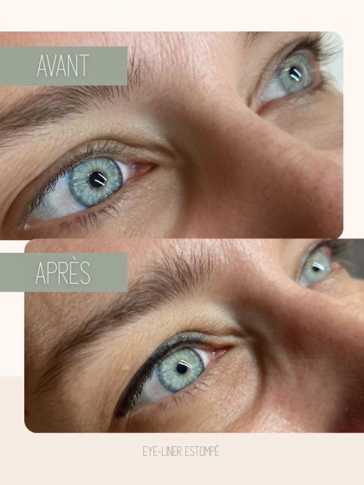 Dermopigmentation esthétique et paramédicale Watermael-Boitsfort