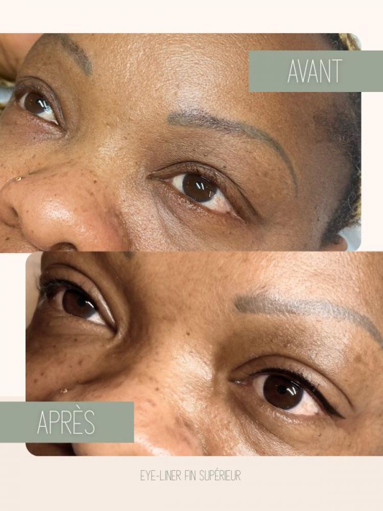 Dermopigmentation esthétique et paramédicale Watermael-Boitsfort